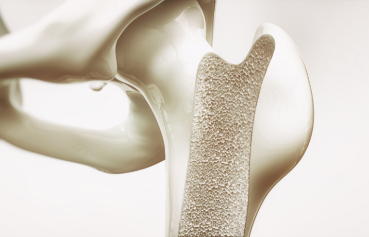 Hasta ahora, las terapias disponibles para la osteoporosis solo logran ralentizar el avance de la enfermedad y muchas de ellas presentan efectos secundarios relevantes o pierden eficacia con el tiempo.