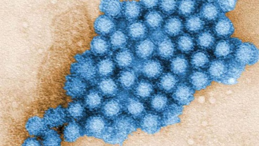 Brote de Norovirus en EE. UU.: Guía médica para proteger a tu familia